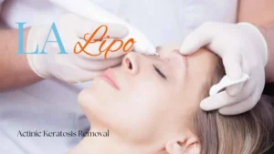 Woman receiving Actinic Keratosis Removal Treatment Oakham